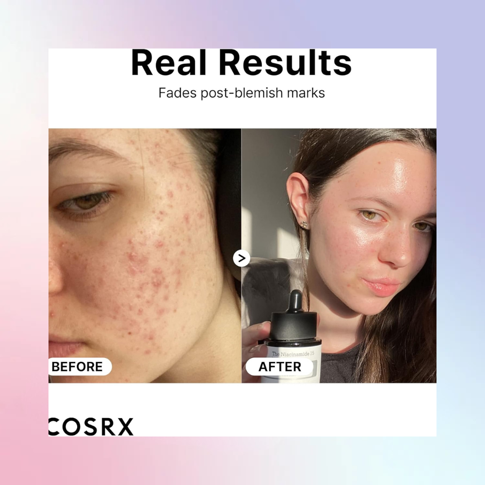 COSRX The Niacinamide 15 Serum 20ml – Wholesale (60 pcs/carton)