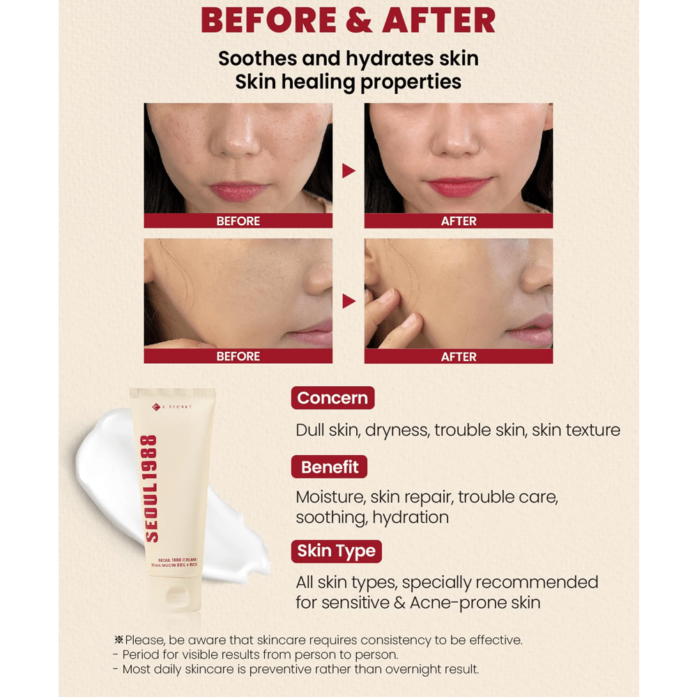 K Secret Seoul 1988 Cream Snail Mucin 93% + Rice - 100 ml – Wholesale (60 pcs/carton)